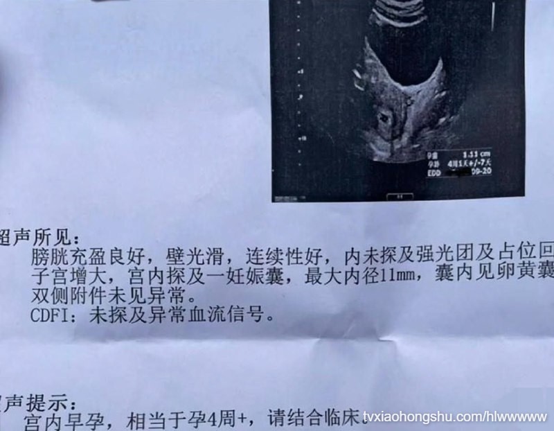 视频详情图 11 - 私房ACG - sifacg.com