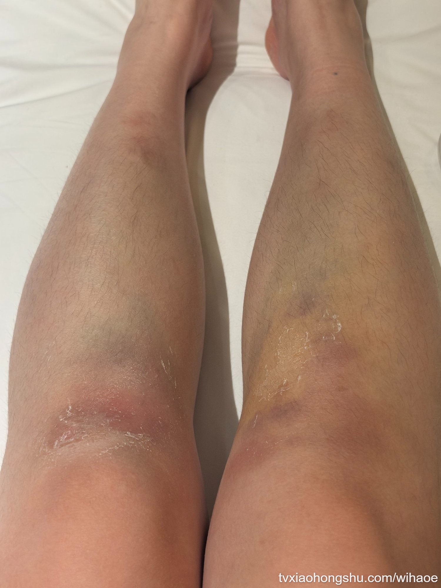 好难受呀 - 私房ACG - sifacg.com